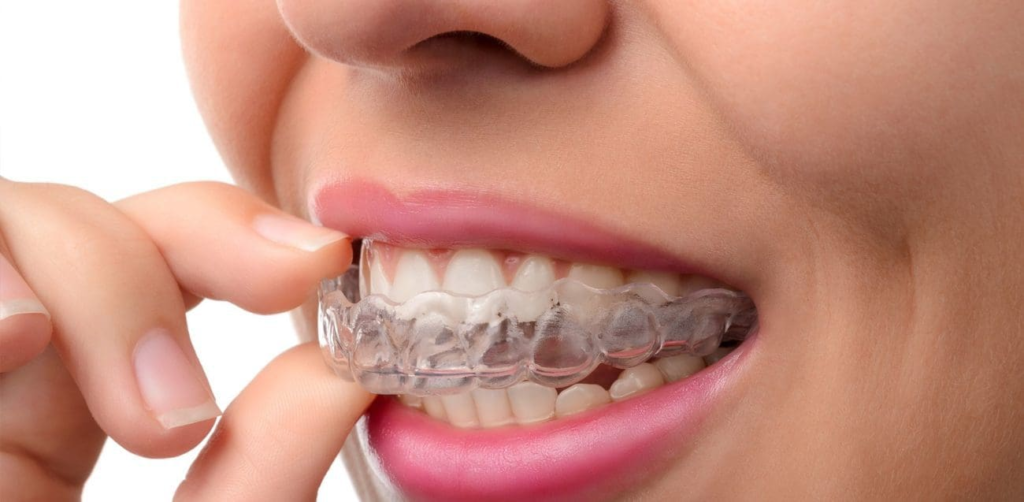 orthodontic treatment